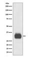 TPS1 antibody, M08039, Boster Biological Technology, Western Blot image 