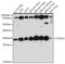 Translational Activator Of Cytochrome C Oxidase I antibody, GTX66382, GeneTex, Western Blot image 