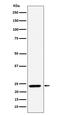DnaJ Heat Shock Protein Family (Hsp40) Member C12 antibody, M13814, Boster Biological Technology, Western Blot image 