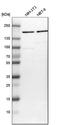 Rho Associated Coiled-Coil Containing Protein Kinase 2 antibody, HPA007459, Atlas Antibodies, Western Blot image 