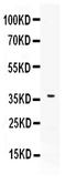 Programmed Cell Death 1 Ligand 2 antibody, PB10010, Boster Biological Technology, Western Blot image 