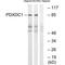Pyridoxal Dependent Decarboxylase Domain Containing 1 antibody, A11375, Boster Biological Technology, Western Blot image 