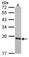 Cysteine Rich Protein 2 antibody, GTX114340, GeneTex, Western Blot image 