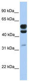 EGF Domain Specific O-Linked N-Acetylglucosamine Transferase antibody, TA330995, Origene, Western Blot image 