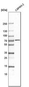 DEAD-Box Helicase 43 antibody, HPA031381, Atlas Antibodies, Western Blot image 