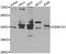 Casein Kinase 1 Gamma 1 antibody, A7510, ABclonal Technology, Western Blot image 