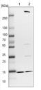 Retinol Binding Protein 7 antibody, NBP1-84383, Novus Biologicals, Western Blot image 