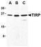 Toll Like Receptor Adaptor Molecule 2 antibody, MBS395790, MyBioSource, Western Blot image 