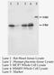 Potassium Calcium-Activated Channel Subfamily N Member 4 antibody, LS-C171767, Lifespan Biosciences, Western Blot image 