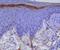 Toll Like Receptor 3 antibody, DDX0470P-100, Novus Biologicals, Immunohistochemistry paraffin image 