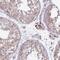 Notch Receptor 2 antibody, NBP2-48913, Novus Biologicals, Immunohistochemistry paraffin image 
