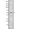 Mitogen-Activated Protein Kinase Kinase 5 antibody, abx216690, Abbexa, Western Blot image 