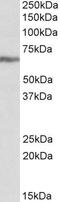 Insulin Like Growth Factor 2 MRNA Binding Protein 1 antibody, GTX88062, GeneTex, Western Blot image 