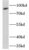 cGMP-dependent protein kinase 2 antibody, FNab06787, FineTest, Western Blot image 