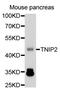 TNFAIP3 Interacting Protein 2 antibody, STJ25904, St John