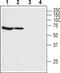 Bestrophin 1 antibody, PA5-77290, Invitrogen Antibodies, Western Blot image 