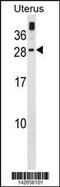 Guanylate Cyclase Activator 1C antibody, 60-944, ProSci, Western Blot image 