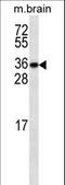 MTOR Associated Protein, LST8 Homolog antibody, LS-C166395, Lifespan Biosciences, Western Blot image 