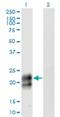 TNF Receptor Superfamily Member 17 antibody, H00000608-M06, Novus Biologicals, Western Blot image 