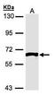 Fyn Related Src Family Tyrosine Kinase antibody, GTX106156, GeneTex, Western Blot image 