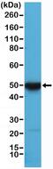 Keratin 17 antibody, MA5-27909, Invitrogen Antibodies, Western Blot image 