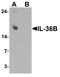 Interleukin 36 Beta antibody, LS-B10136, Lifespan Biosciences, Western Blot image 