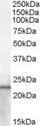 Lipocalin 2 antibody, EB08266, Everest Biotech, Western Blot image 