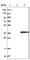 Short Chain Dehydrogenase/Reductase Family 16C Member 5 antibody, HPA025224, Atlas Antibodies, Western Blot image 