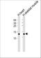 Fatty Acid Binding Protein 3 antibody, A01734-2, Boster Biological Technology, Western Blot image 