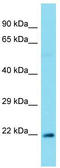 Claudin 4 antibody, TA334201, Origene, Western Blot image 