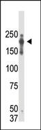 PR/SET Domain 2 antibody, AM11041PU-N, Origene, Western Blot image 