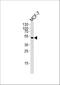 Suppressor of cytokine signaling 4 antibody, A09261-1, Boster Biological Technology, Western Blot image 