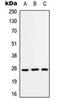 RAB33A, Member RAS Oncogene Family antibody, orb214893, Biorbyt, Western Blot image 