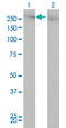 Chromodomain Helicase DNA Binding Protein 4 antibody, LS-B4300, Lifespan Biosciences, Western Blot image 