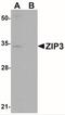 Solute Carrier Family 39 Member 3 antibody, NBP1-76500, Novus Biologicals, Western Blot image 