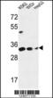 Pyrroline-5-Carboxylate Reductase 1 antibody, 64-173, ProSci, Western Blot image 