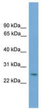 Distal-Less Homeobox 4 antibody, TA341752, Origene, Western Blot image 