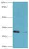 Carbonyl Reductase 3 antibody, MBS1497578, MyBioSource, Western Blot image 