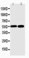 Nuclear Factor Kappa B Subunit 2 antibody, LS-C313084, Lifespan Biosciences, Western Blot image 