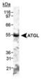 Patatin-like phospholipase domain-containing protein 2 antibody, TA301537, Origene, Western Blot image 