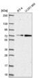 Zinc Finger Protein 616 antibody, NBP2-57531, Novus Biologicals, Western Blot image 