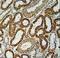 NADH:Ubiquinone Oxidoreductase Subunit C2 antibody, LS-C164810, Lifespan Biosciences, Immunohistochemistry paraffin image 