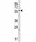 Glypican 3 antibody, F49601-0.4ML, NSJ Bioreagents, Western Blot image 