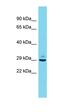 Proprotein Convertase Subtilisin/Kexin Type 1 Inhibitor antibody, orb326284, Biorbyt, Western Blot image 