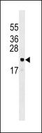 ADP Ribosylation Factor Like GTPase 6 Interacting Protein 5 antibody, 59-176, ProSci, Western Blot image 