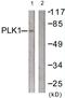Polo Like Kinase 1 antibody, LS-C117697, Lifespan Biosciences, Western Blot image 