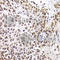 Pleckstrin Homology Domain Interacting Protein antibody, A7207, ABclonal Technology, Immunofluorescence image 