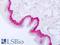 Keratin 14 antibody, LS-C22642, Lifespan Biosciences, Immunohistochemistry paraffin image 