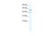 Potassium Two Pore Domain Channel Subfamily K Member 10 antibody, 28-282, ProSci, Western Blot image 