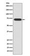 Activating Transcription Factor 2 antibody, M00916, Boster Biological Technology, Western Blot image 